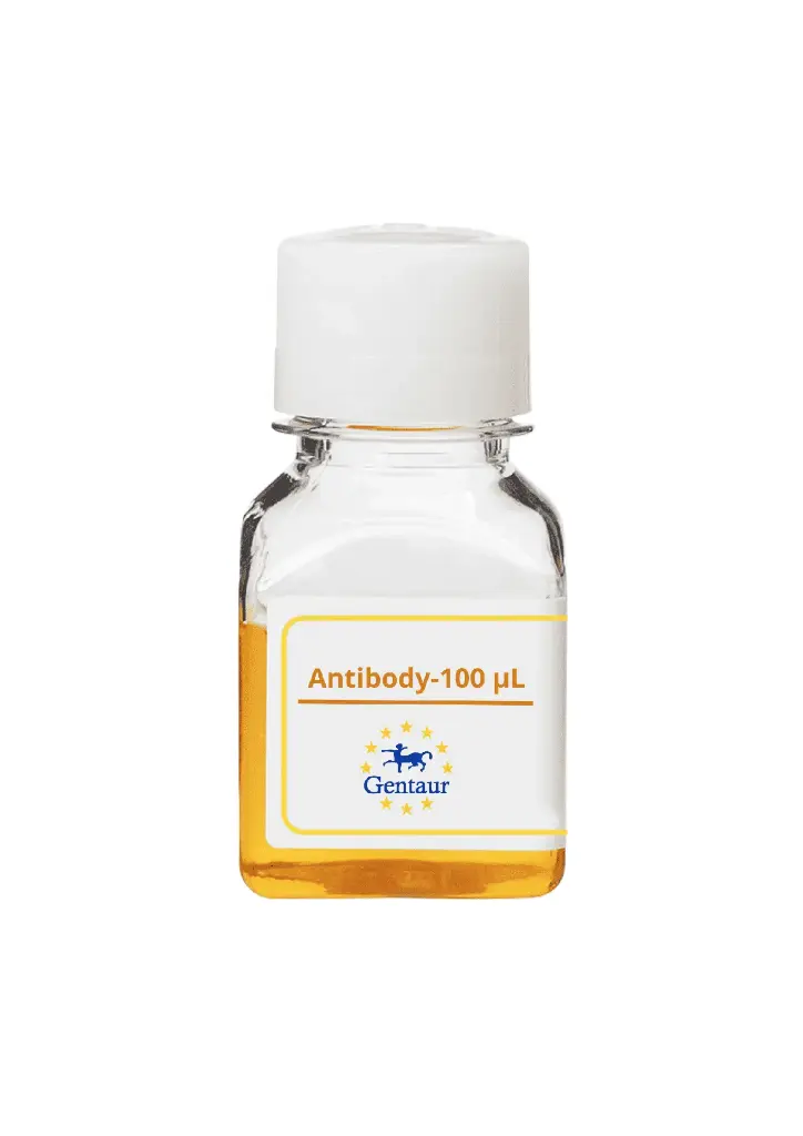 ALKBH3 Antibody  FITC conjugated   